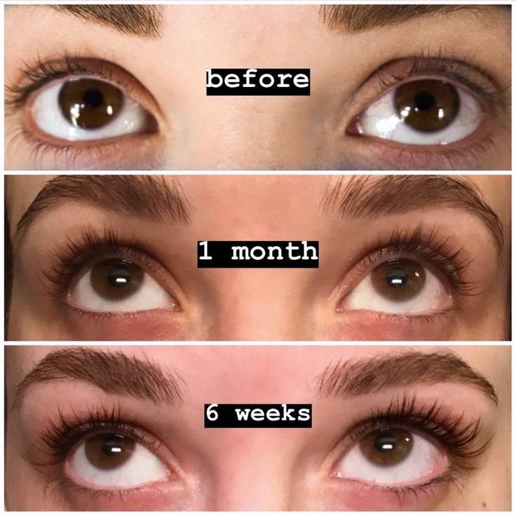 Eyelash Growth Serum